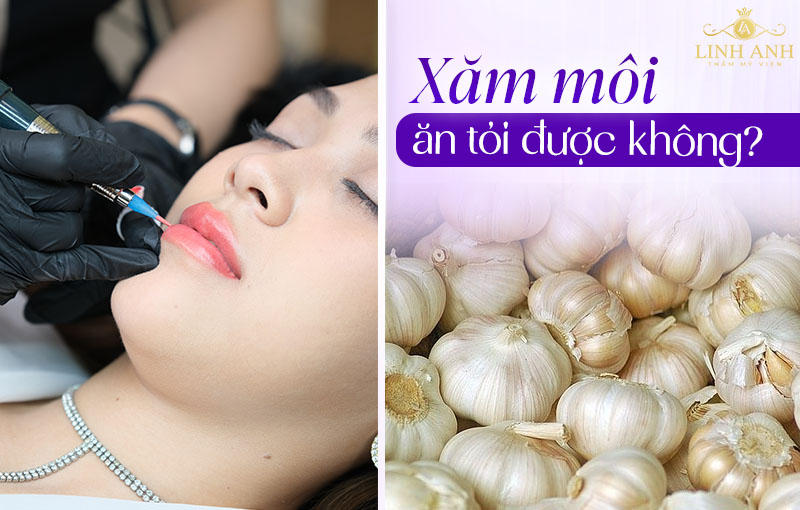 Phun môi ăn tỏi được không