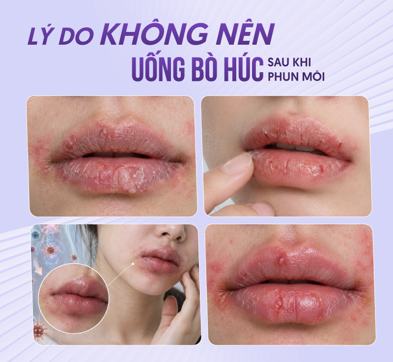 Uống bò húc gây mất nước môi phun