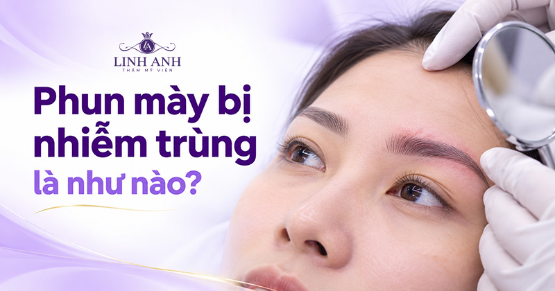 Phun mày xong bị nhiễm trùng