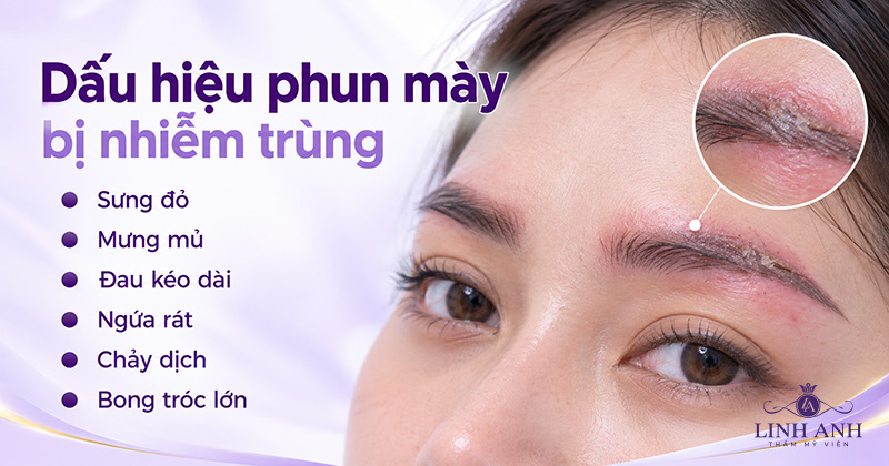 Sưng đau kéo dài là dấu hiệu nhiễm trùng phun mày