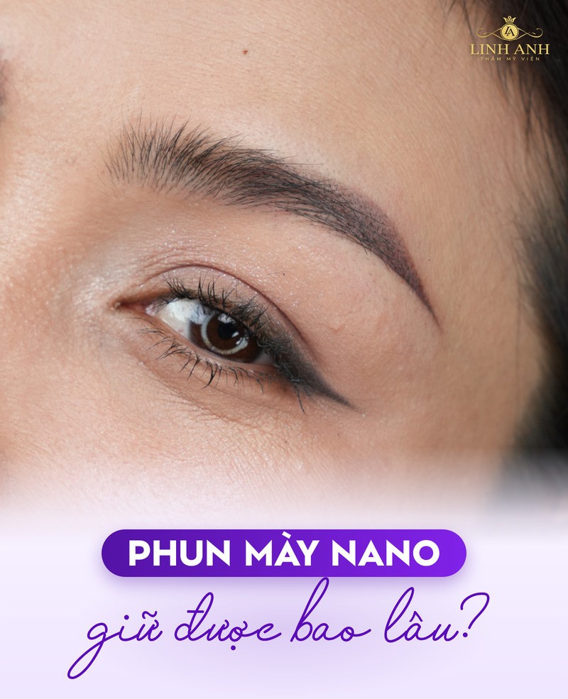 Phun mày nano giữ được 2-3 năm