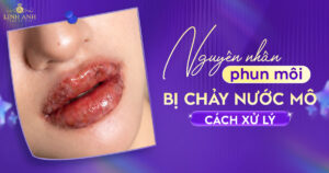 Phun xăm môi bị chảy nước mô