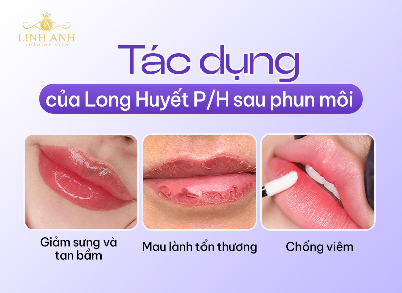 Long huyết chống viêm môi sau phun