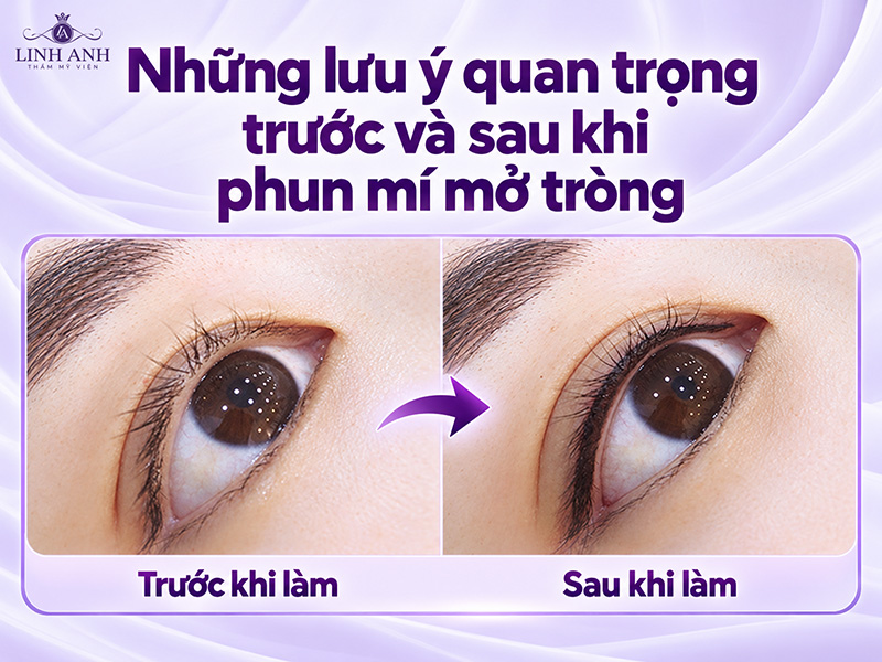 Phun mí mở tròng Hàn Quốc: Ưu điểm, lưu ý và quy trình chuẩn 24 Lưu ý trước và sau khi phun mí