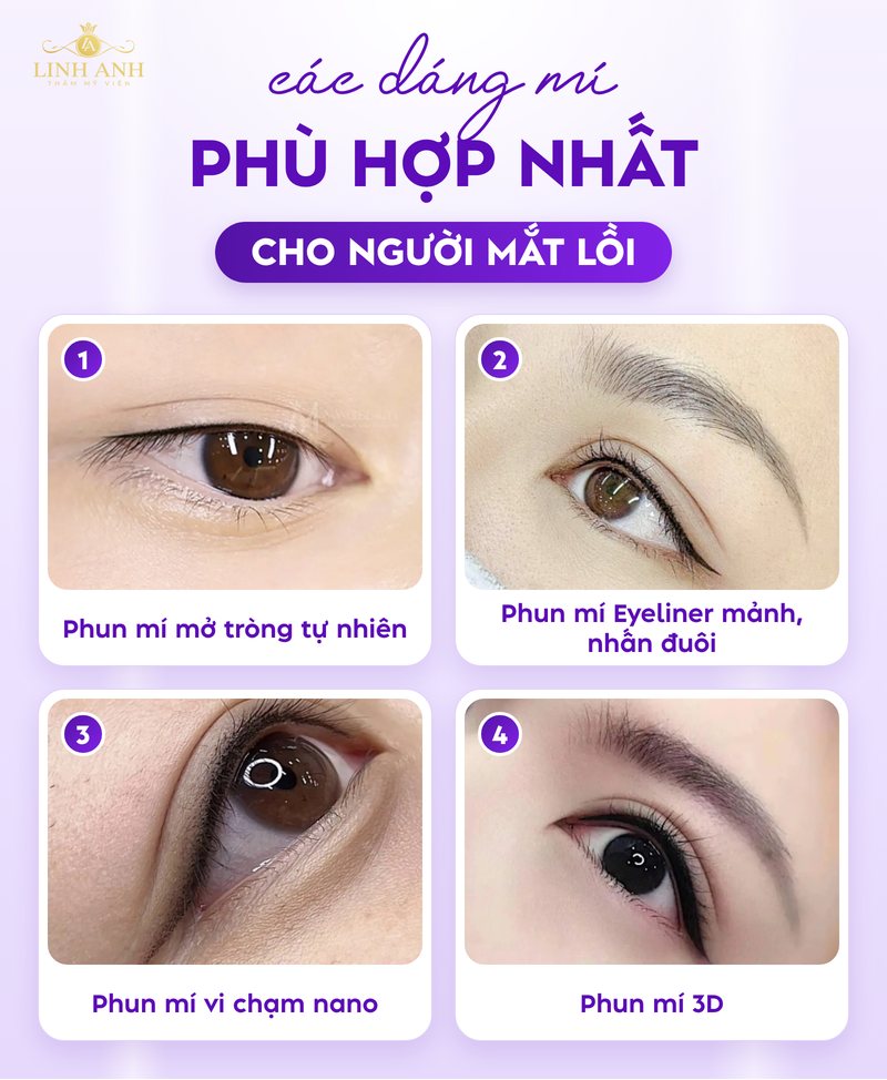 Mắt lồi có nên phun mí không? Cần lưu ý điều gì? 19 Dáng mí phù hợp cho người mắt lồi