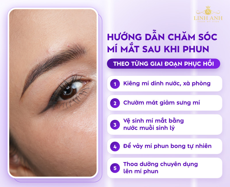 Cách chăm sóc mí mắt sau khi phun và một số LƯU Ý cần biết 18 Chăm sóc mí mắt đúng cách sau phun