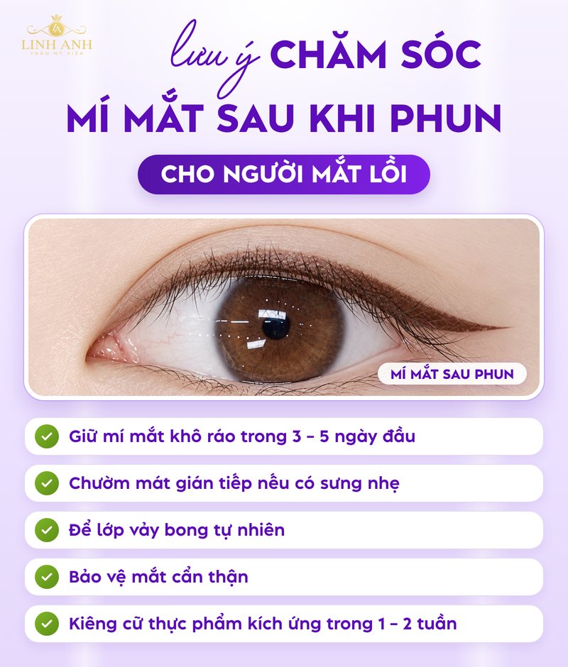 Mắt lồi có nên phun mí không? Cần lưu ý điều gì? 20 Lưu ý chăm sóc phun mí mắt lồi