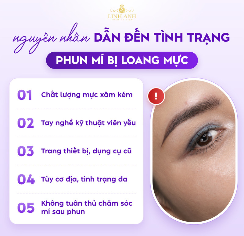 Phun mí bị loang mực: Dấu hiệu, nguyên nhân và cách khắc phục an toàn 18 Nguyên nhân khiến mí loang mực