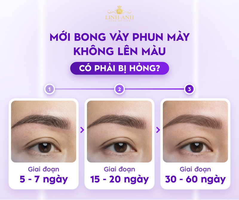 Phun mày không lên màu: Nguyên nhân và cách xử lý hiệu quả 7 Các giai đoạn bong vảy