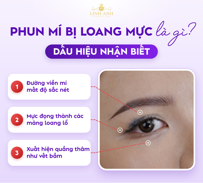 Phun mí bị loang mực: Dấu hiệu, nguyên nhân và cách khắc phục an toàn 17 Đường mí loang mất độ sắc nét
