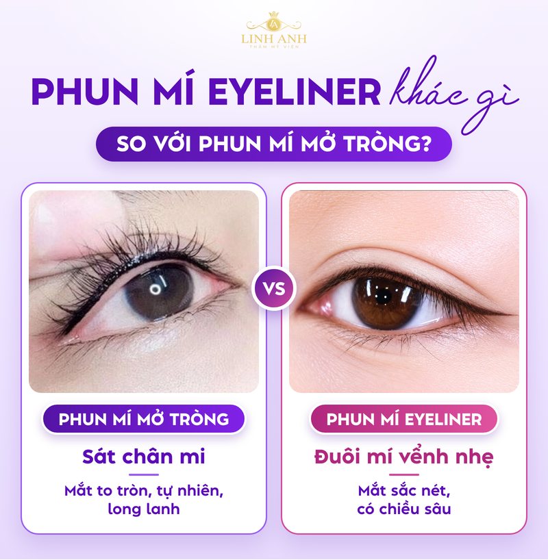 Phun Mí Eyeliner Là Gì? Ưu Điểm, Bảng Giá Và Cách Chăm Sóc Đúng Cách 8 Phun mí eyeliner là gì