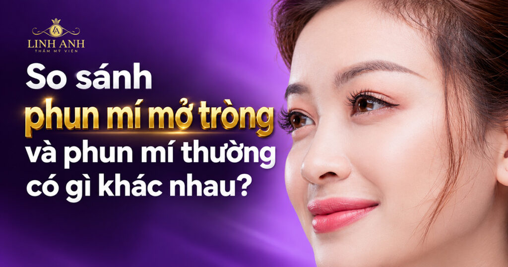 So sánh phun mí mở tròng và phun mí thường có gì khác nhau? 10 Phun mí mở tròng và phun mí thường khác gì nhau