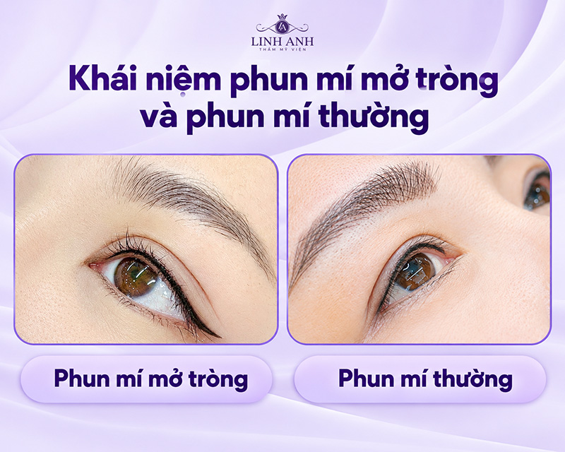 So sánh phun mí mở tròng và phun mí thường có gì khác nhau? 11 Khái niệm phun mí mở tròng và phun mí thường