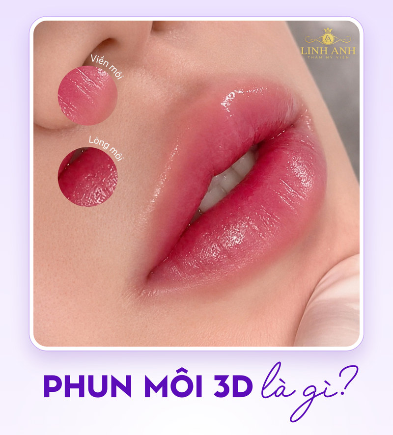 Phun môi 3D là gì? Ưu & Nhược điểm cần lưu ý 20 Phun môi 3D tạo cảm giác đa chiều cho môi