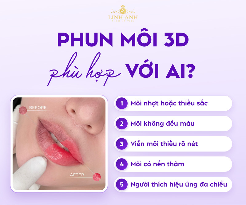 Phun môi 3D là gì? Ưu & Nhược điểm cần lưu ý 23 Phun môi 3D giúp cải thiện nền môi