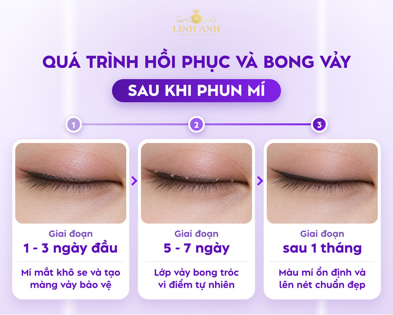 Phun mí bao lâu thì bong? Quá trình hồi phục và cách chăm sóc chuẩn 7 Quá trình hồi phục sau khi phun mí