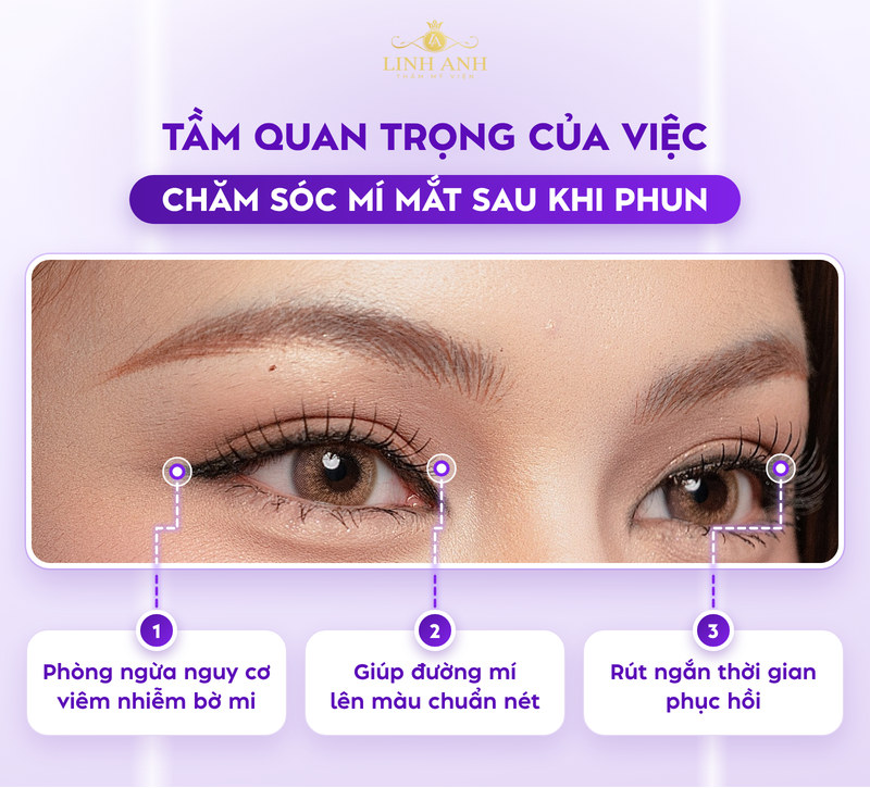 Cách chăm sóc mí mắt sau khi phun và một số LƯU Ý cần biết 17 Cách chăm sóc mí mắt sau phun