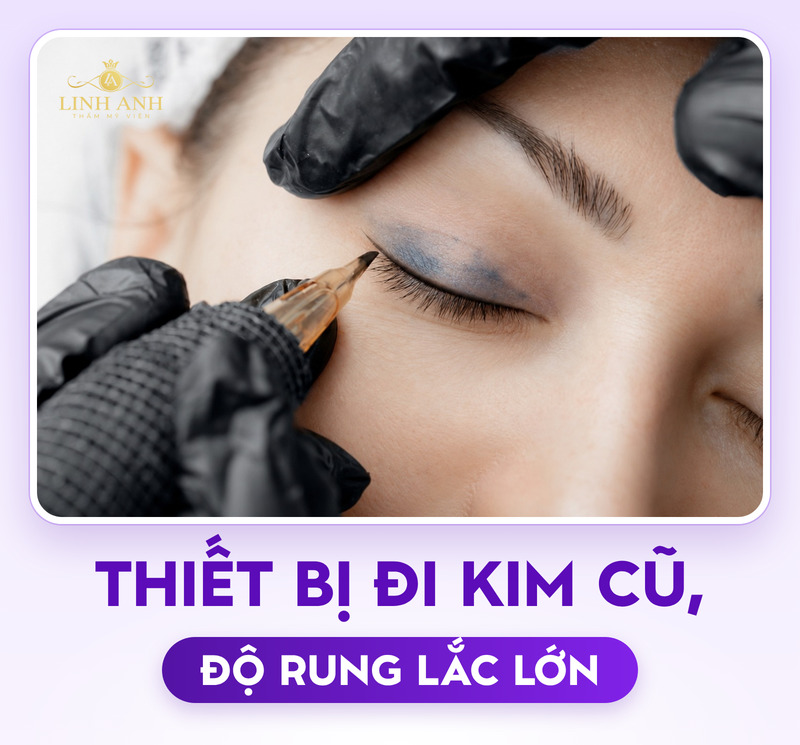 Phun mí bị loang mực: Dấu hiệu, nguyên nhân và cách khắc phục an toàn 19 Thiết bị kim cũ có thể khiến phun mí loang màu